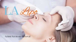 Woman receiving Actinic Keratosis Removal Treatment Walton-on-Thames