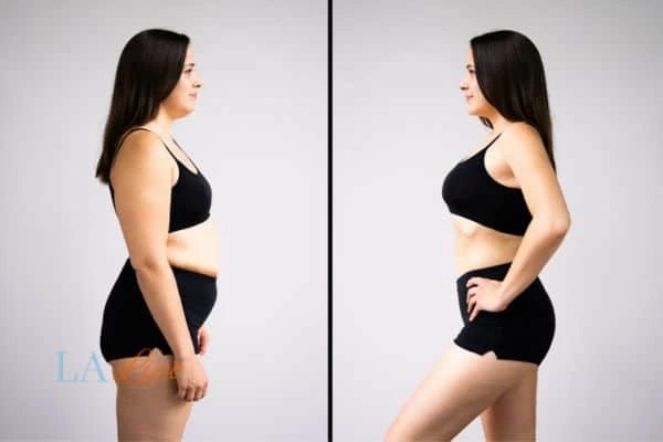 LA-EMS Body Sculpting Walton-on-Thames results before and after of womans results on body toning.
