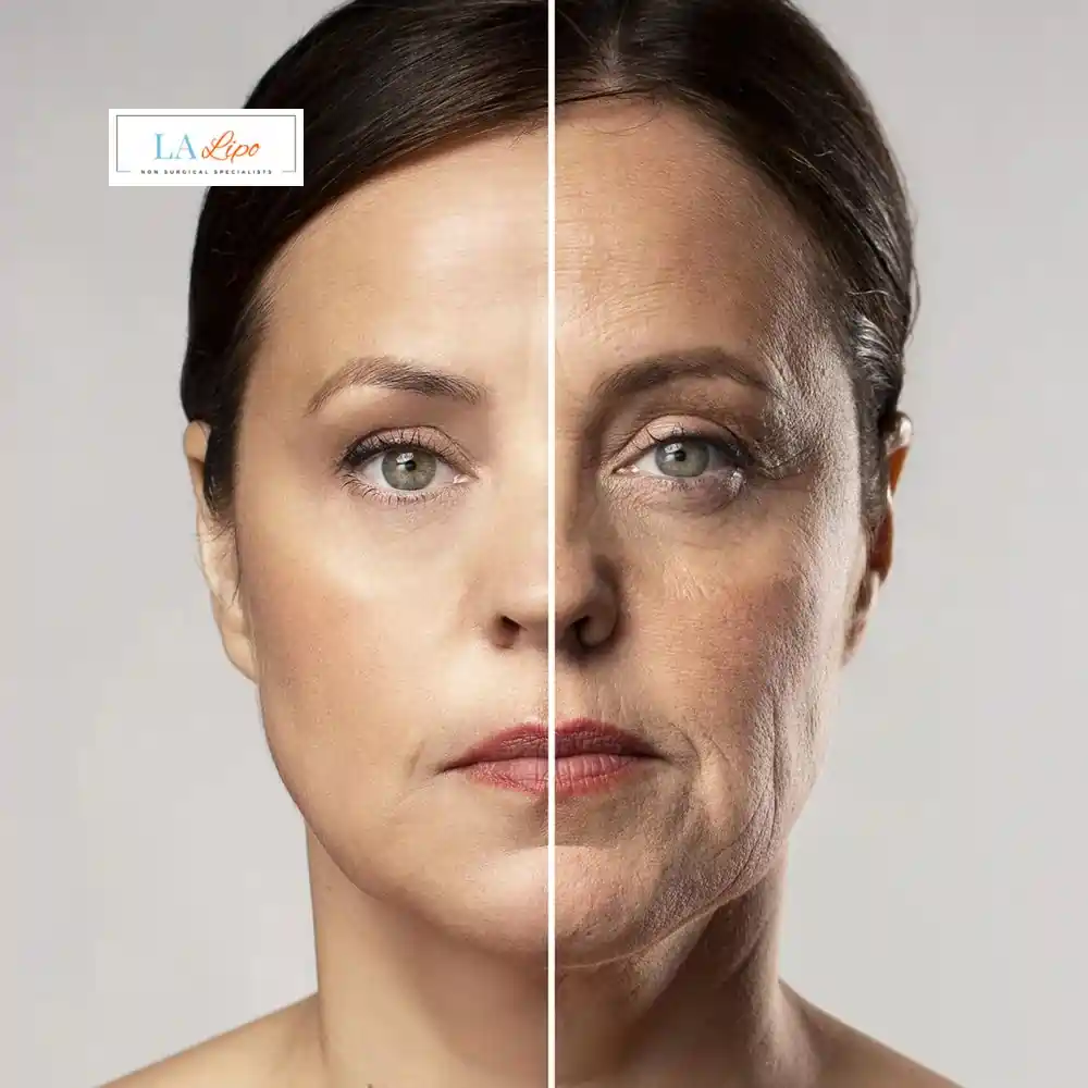 How Can You Tell If Non-Surgical Skin Tightening Is Right for You Walton-on-Thames?