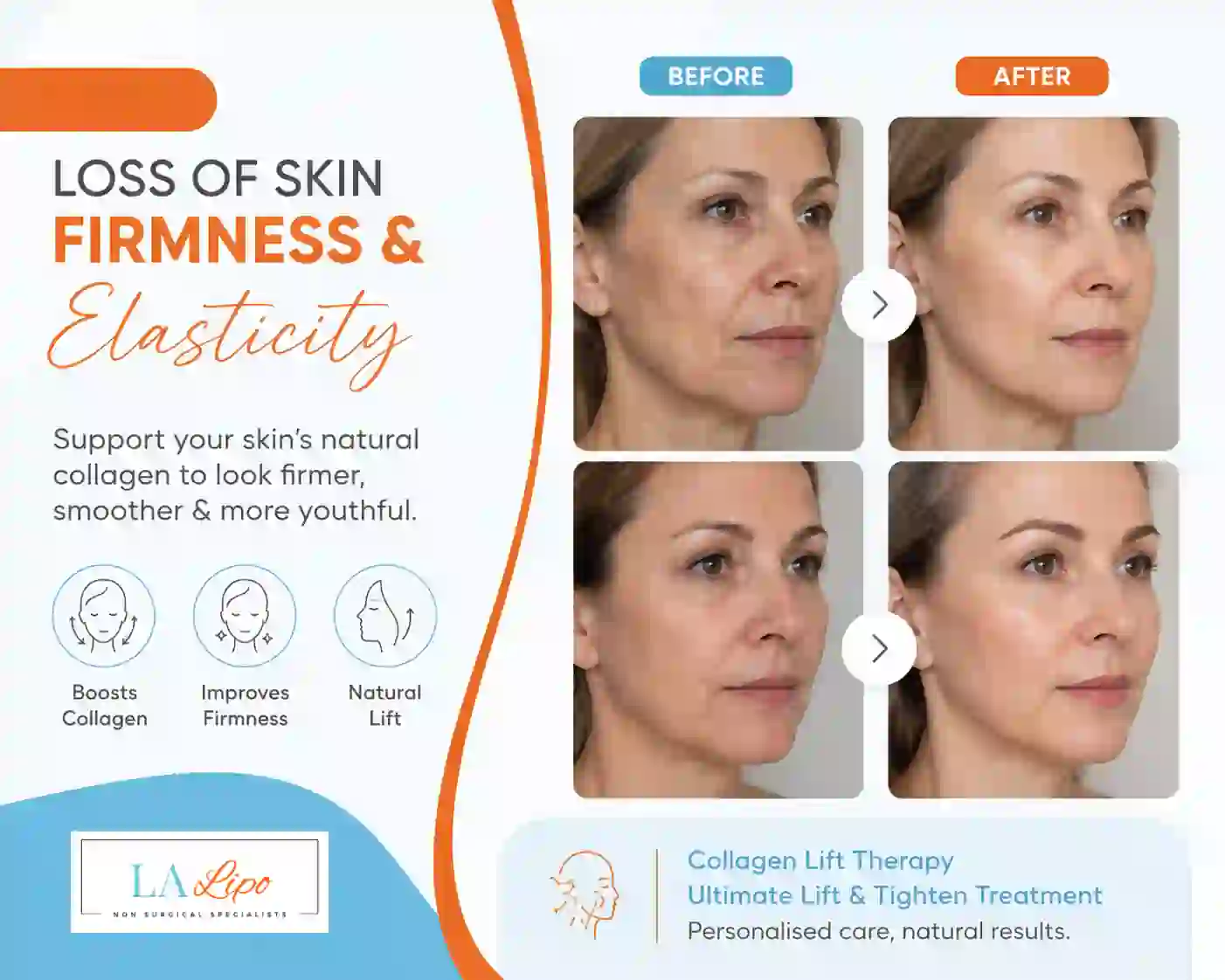 Sign #7: Loss of Skin Firmness and Elasticity Walton-on-Thames