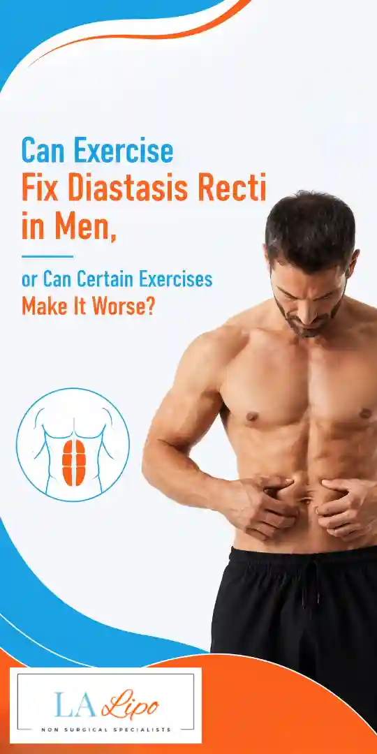 Can Exercise Fix Diastasis Recti in Men, or Can Certain Exercises Make It Worse Walton-on-Thames?